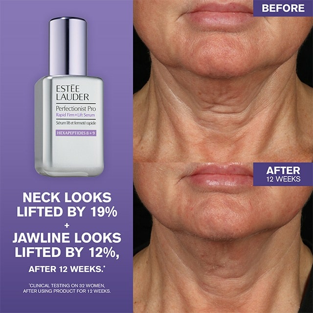 Estée Lauder Perfectionist Pro Rapid Firm Lift Serum with Hexapeptides 8 9 - Siero Viso Anti-età 50 ml