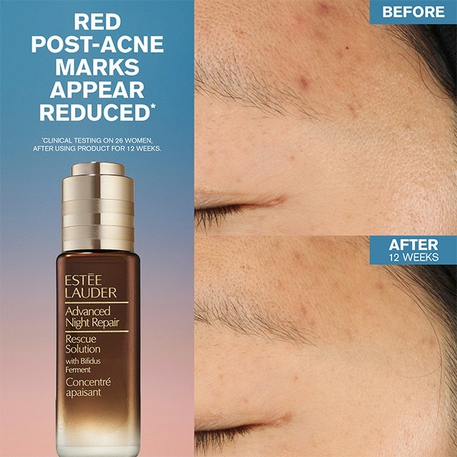 Estée Lauder Advanced Night Repair Rescue Solution Serum 20 ml - Siero lenitivo per pelli sensibili con 15% di Bifidus Ferment