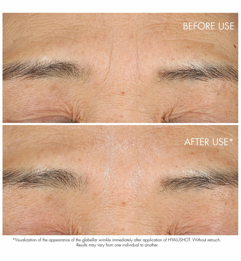 Dior Capture Totale Hyalushot - Siero Correttore Multi-Rughe 15 ml per Occhi, 97% Ingredienti Naturali