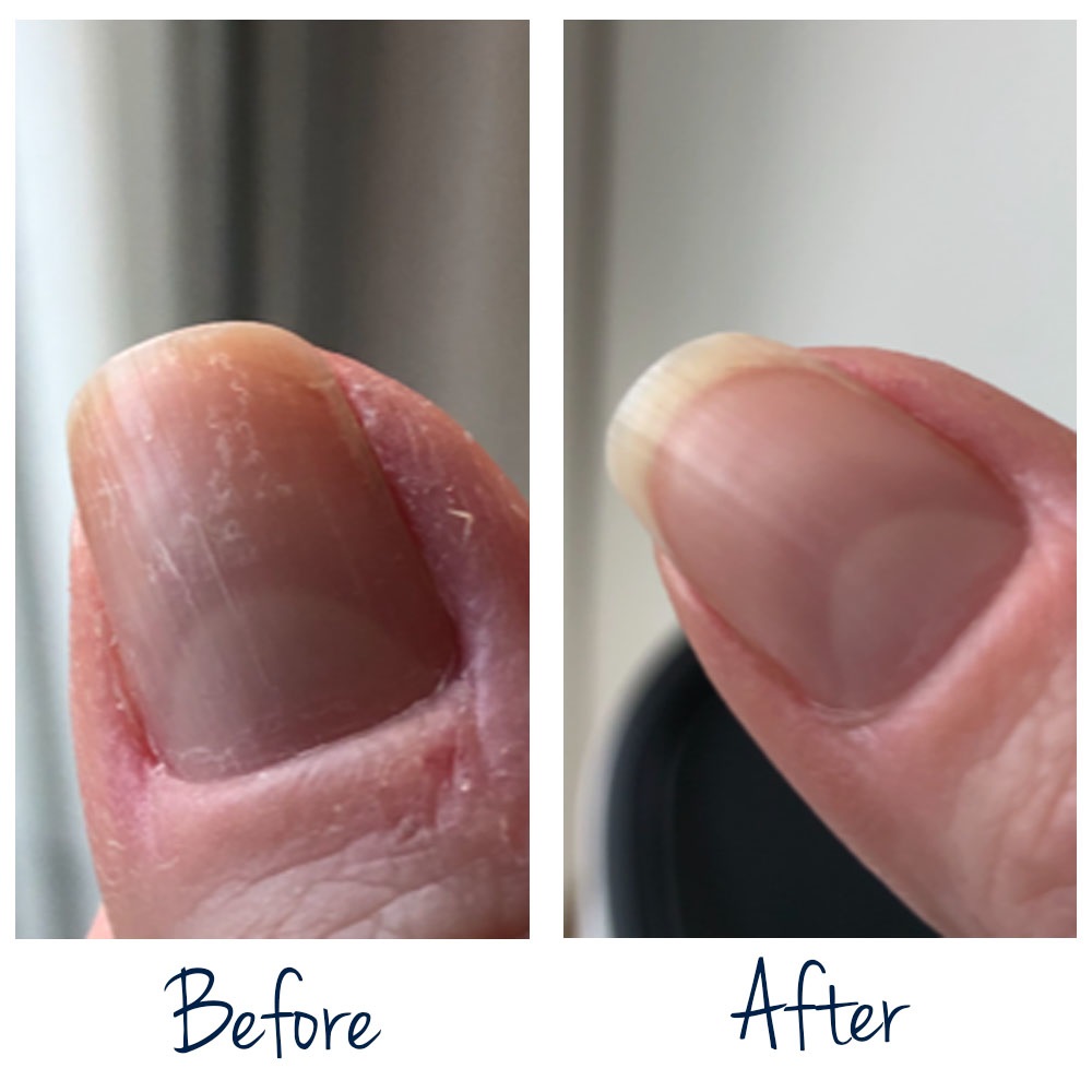 Herome Olio Rinforzante Unghie Extra Forte 7 ml - Ripara Unghie Estremamente Danneggiate e Fragili